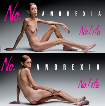 anorexia01.jpg
